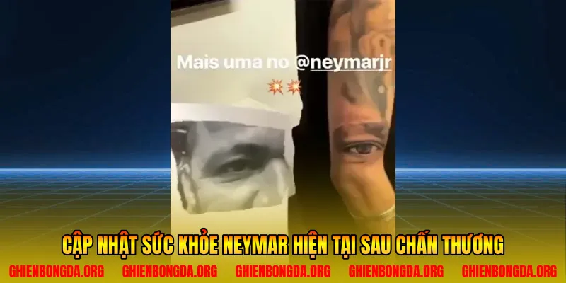 Cập nhật sức khỏe Neymar hiện tại sau chấn thương